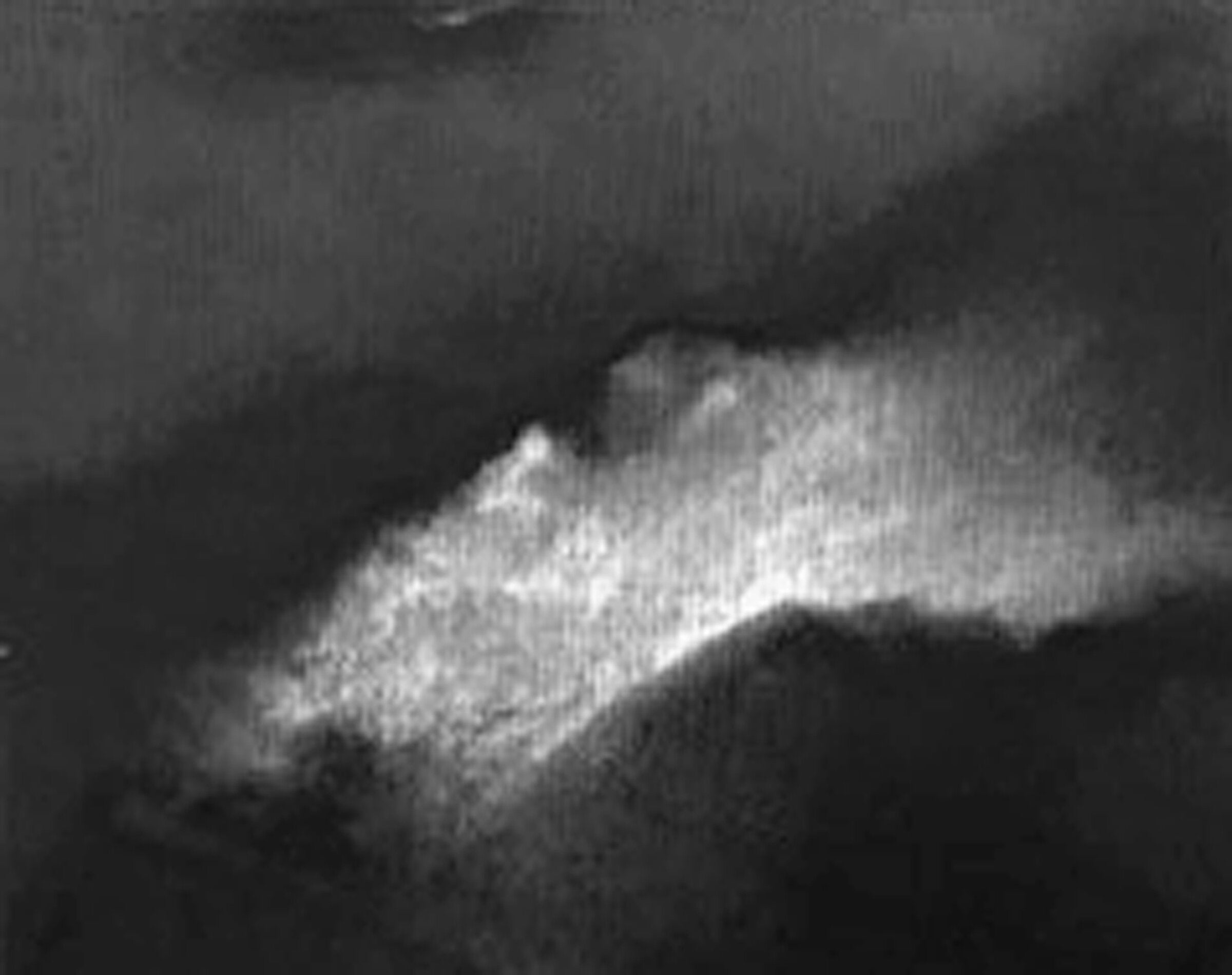 Breakthrough I